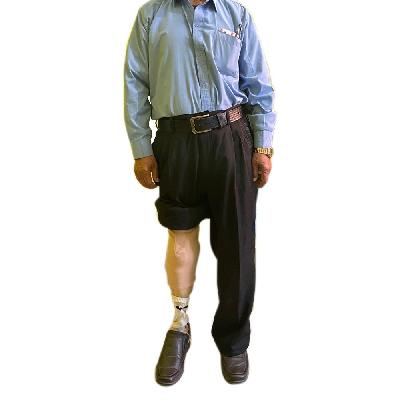 Below Knee Modular Prosthetic