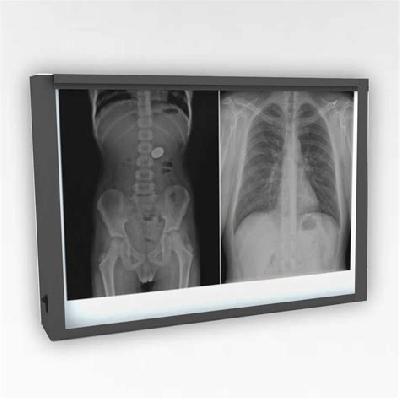 LED X Ray View Box