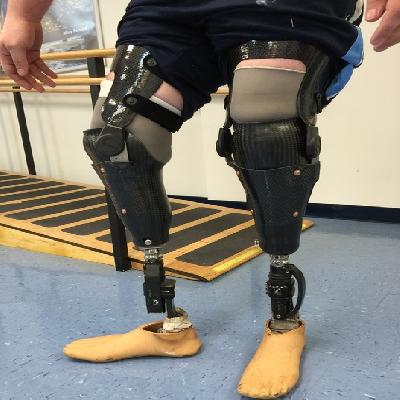 Knee Joint Prosthesis Leg