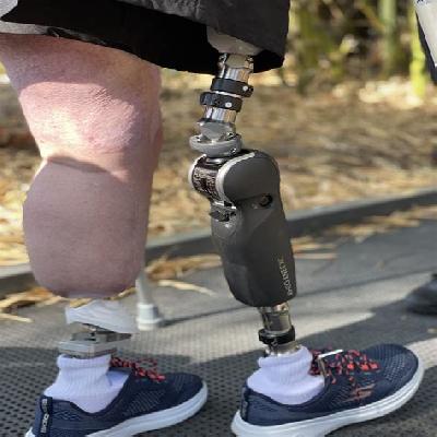 Artificial Legs