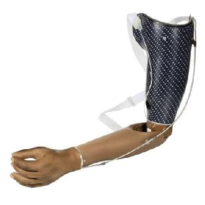 Upper Limb Prosthesis