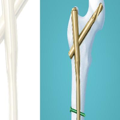 PFN 2 Nail Long Blade