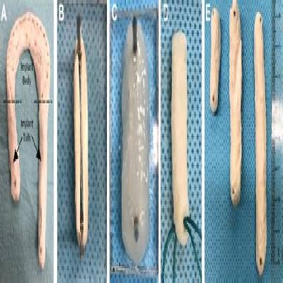 Endobutton Suture Wheel