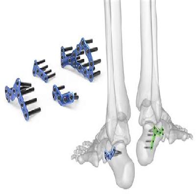 Calcaneal Plates