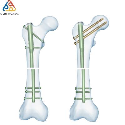 Interlocking Nail S Cap