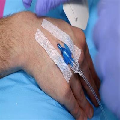IV Cannula