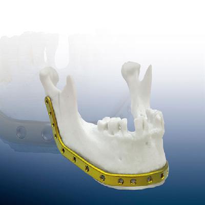 Titanium Reconstruction Plates For Full Mandible U Shape