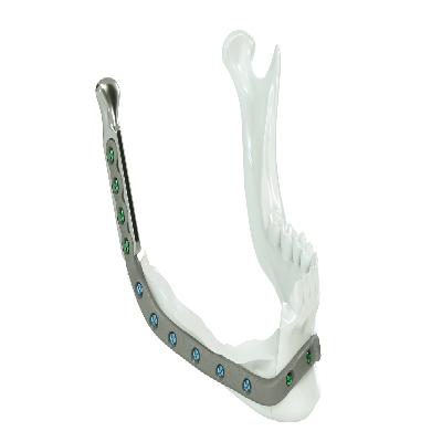Tmj Condyle Reconstruction Plates