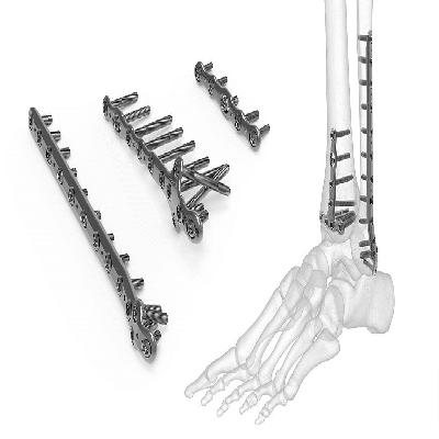 90 Degree L Shaped Bone Plates with Bar