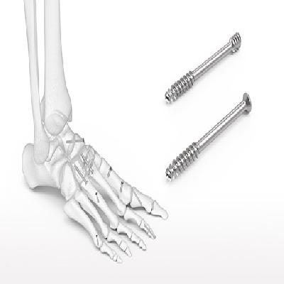 Mini Bone Screws Single Slot Head