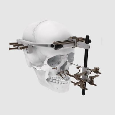 S.S. Pediatric Maxillary Distractor
