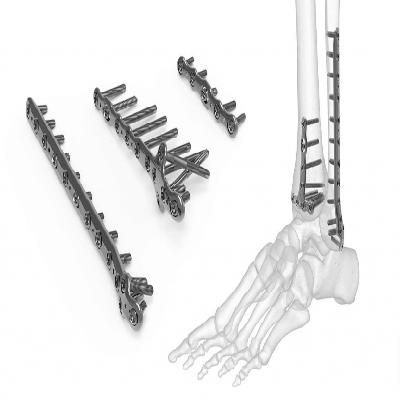 Y Double Shaped Bone Plates