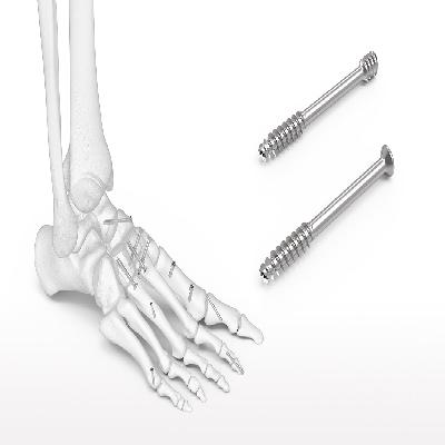 Mini Bone Screw 3
