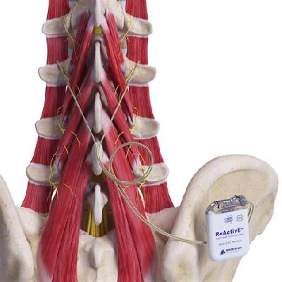 Neurological stimulus