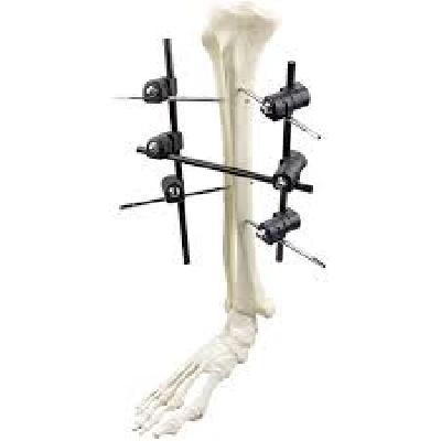 SUTUREFIX TIBIAL BASE PLATES
