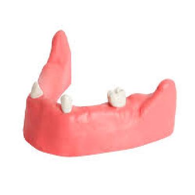 Dental Mandible With Gingiva For Implant Training