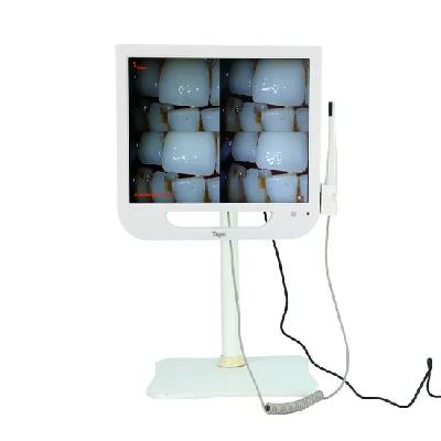 Icontrasters For Oral Dental Photography