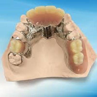 Partial Model For Prosthesis