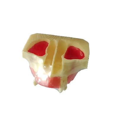 Sinus Lift Model - White Resin