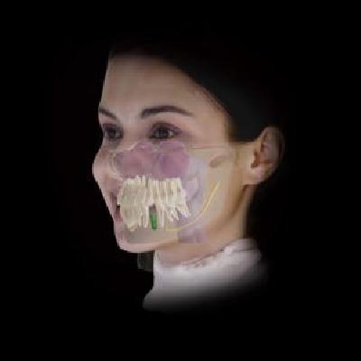 Transparent Dental Implant Mandible