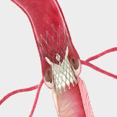 Core Valve