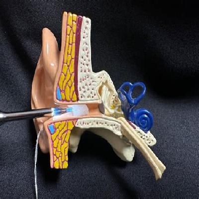 Eustachian Catheter