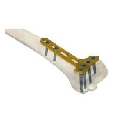 LCP Small T Plate