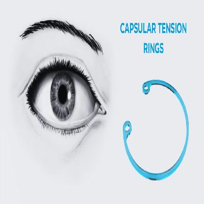 Capsular Tension Rings