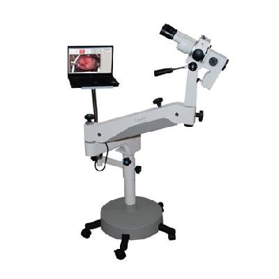 Video Colposcope
