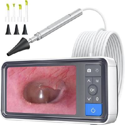 Video Otoscope