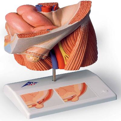 Inguinal Hernia Fiberglass Model