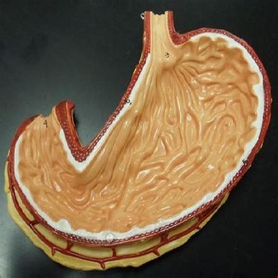 NSAW Stomach Model