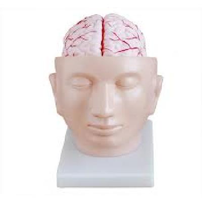 Brian With Arteries On Head