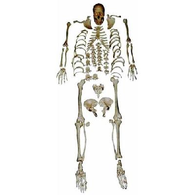 Disarticulated Skeleton
