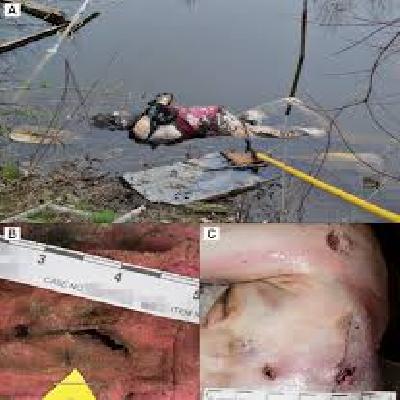 Drowning Forensic Model