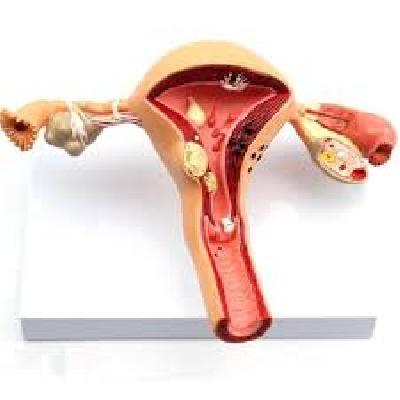 Ovary Model