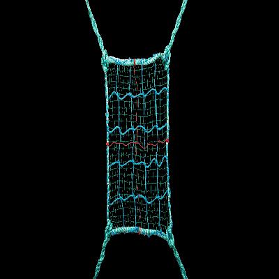 Braided Safety Net