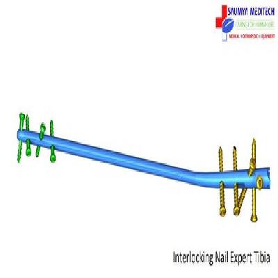 Interlocking Nail Expert Tibia