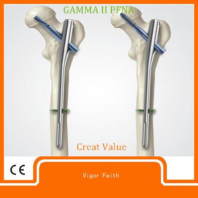 Interlocking Nail PFN