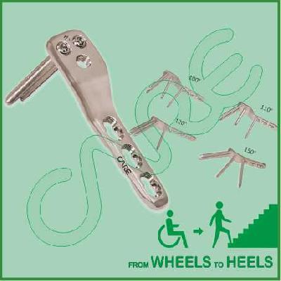 SS Looking 95 Hip Plate