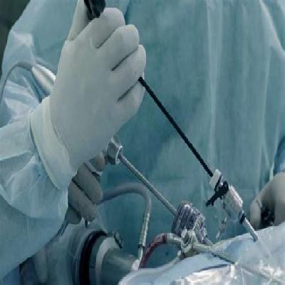 Hysteroscopy Operation 