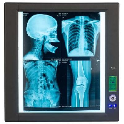 X Ray View Box Single